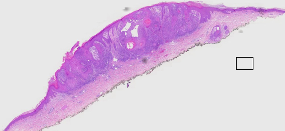 DermatoPathology