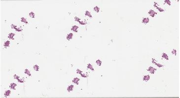 Duodenal