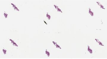 Duodenal