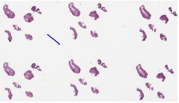 GI