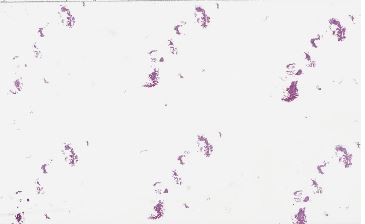 GI
